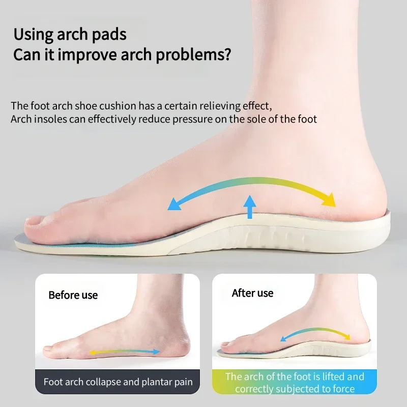 1Pair Orthopedic Arch Support  - đánh giá và giá Men'S Shoes For Plantar Fasciitis